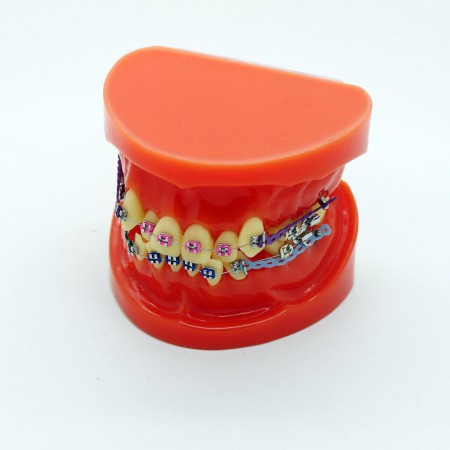 YZDKJDZ Modèle De Dents, Modèle De Dent Orale Orthodontique avec 32 Dents  Amovibles, Modèle De Gencive Molle pour Typodont, pour Démonstration De